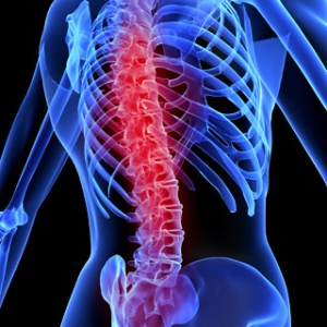 Spinal-Cord-Disease-