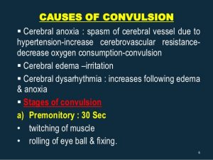 convulsions causes